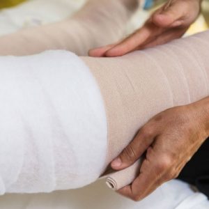 Il Bendaggio Elastocompressivo